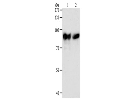 ACO2 Polyclonal Antibody Store at -20°C - Biomarkers - Elabscience Biotechnology - MSE Supplies