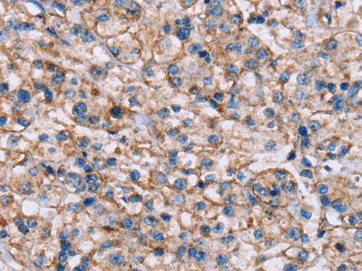 ADAM12 Polyclonal Antibody Store at -20°C - Biomarkers - Elabscience Biotechnology - MSE Supplies