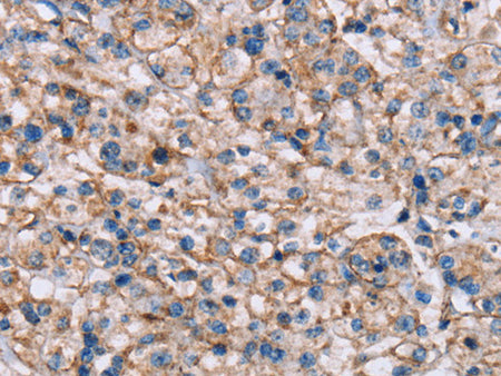 ADAM12 Polyclonal Antibody Store at -20°C - Biomarkers - Elabscience Biotechnology - MSE Supplies