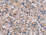 ADAM12 Polyclonal Antibody Store at -20°C