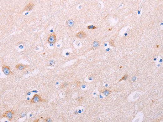 ADCY5 Polyclonal Antibody Store at -20°C - Biomarkers - Elabscience Biotechnology - MSE Supplies