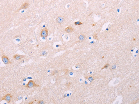ADCY5 Polyclonal Antibody Store at -20°C - Biomarkers - Elabscience Biotechnology - MSE Supplies
