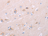 ADCY5 Polyclonal Antibody Store at -20°C