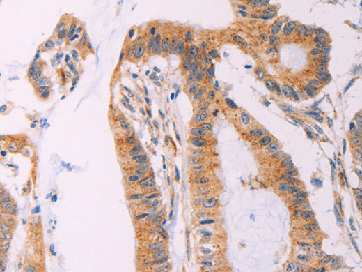 ADCY1 Polyclonal Antibody Store at -20°C - Biomarkers - Elabscience Biotechnology - MSE Supplies