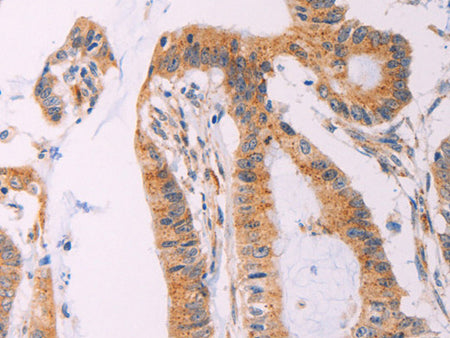 ADCY1 Polyclonal Antibody Store at -20°C - Biomarkers - Elabscience Biotechnology - MSE Supplies
