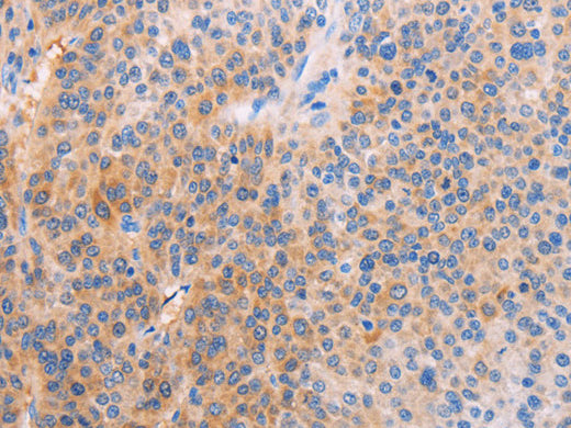 ADHFE1 Polyclonal Antibody Store at -20°C - Biomarkers - Elabscience Biotechnology - MSE Supplies