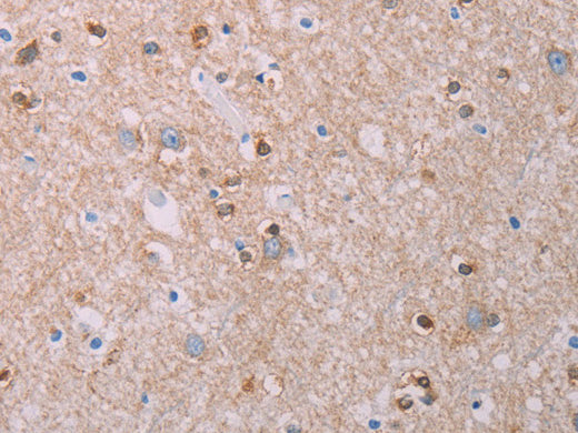 AKT2 Polyclonal Antibody Store at -20°C - Biomarkers - Elabscience Biotechnology - MSE Supplies
