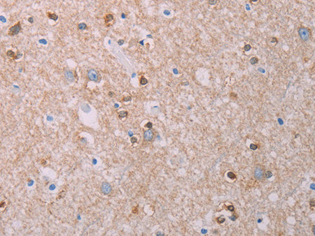 AKT2 Polyclonal Antibody Store at -20°C - Biomarkers - Elabscience Biotechnology - MSE Supplies