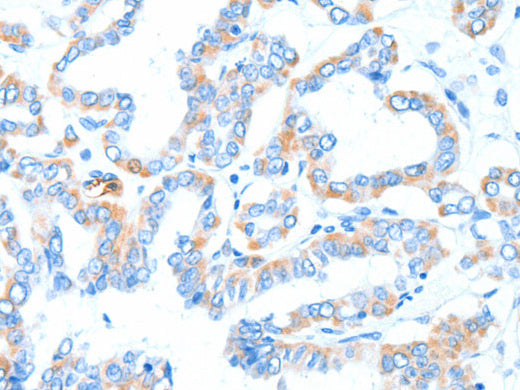 GPT Polyclonal Antibody Store at -20°C - Biomarkers - Elabscience Biotechnology - MSE Supplies