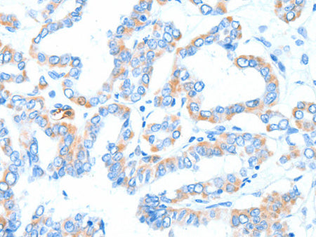 GPT Polyclonal Antibody Store at -20°C - Biomarkers - Elabscience Biotechnology - MSE Supplies