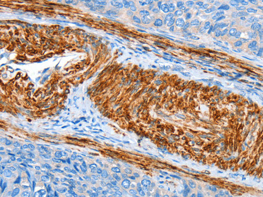 AARS Polyclonal Antibody Store at -20°C - Biomarkers - Elabscience Biotechnology - MSE Supplies