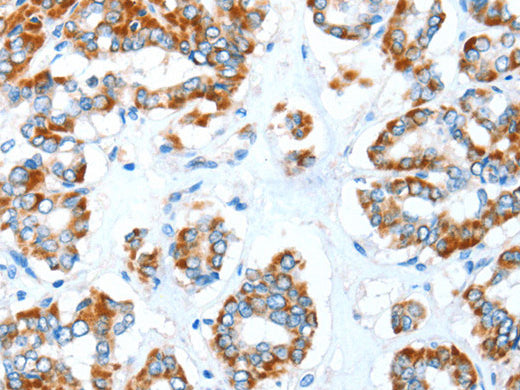 ALDH5A1 Polyclonal Antibody Store at -20°C - Biomarkers - Elabscience Biotechnology - MSE Supplies