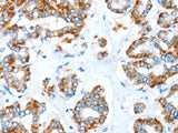 ALDH5A1 Polyclonal Antibody Store at -20°C