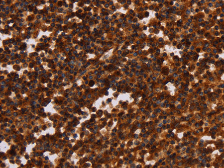 ALG11 Polyclonal Antibody Store at -20°C - Biomarkers - Elabscience Biotechnology - MSE Supplies