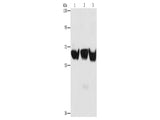 ADRA1B Polyclonal Antibody Store at -20°C