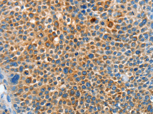 SERPINF2 Polyclonal Antibody Store at -20°C - Biomarkers - Elabscience Biotechnology - MSE Supplies
