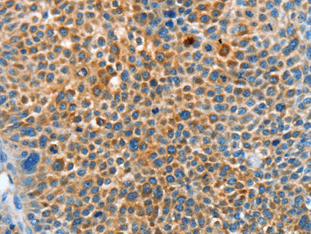 SERPINF2 Polyclonal Antibody Store at -20°C - Biomarkers - Elabscience Biotechnology - MSE Supplies