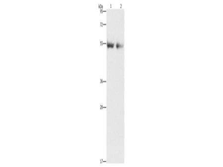 ANGPT4 Polyclonal Antibody Store at -20°C - Biomarkers - Elabscience Biotechnology - MSE Supplies