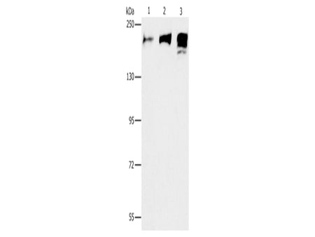ACE1 Polyclonal Antibody Store at -20°C - Biomarkers - Elabscience Biotechnology - MSE Supplies