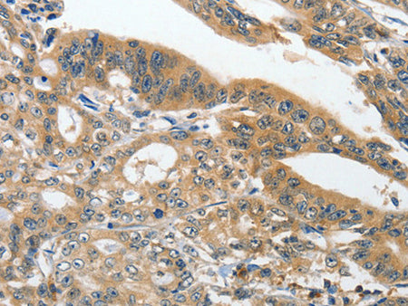 ANKZF1 Polyclonal Antibody Store at -20°C - Biomarkers - Elabscience Biotechnology - MSE Supplies