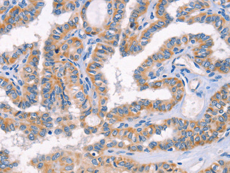 AP1B1 Polyclonal Antibody Store at -20°C - Biomarkers - Elabscience Biotechnology - MSE Supplies