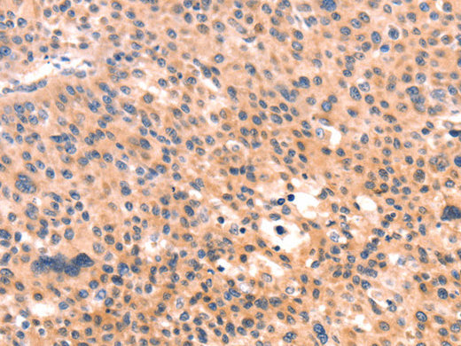 APBA2 Polyclonal Antibody Store at -20°C - Biomarkers - Elabscience Biotechnology - MSE Supplies