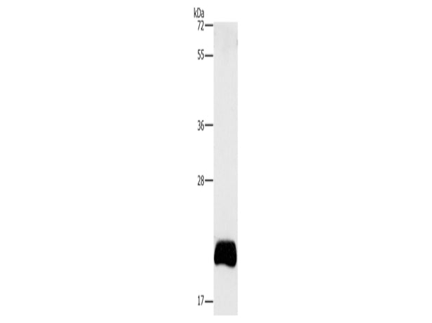 APOBEC3C Polyclonal Antibody Store at -20°C - Biomarkers - Elabscience Biotechnology - MSE Supplies