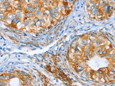 AIP Polyclonal Antibody Store at -20°C - Biomarkers - Elabscience Biotechnology - MSE Supplies