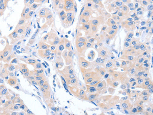 ARHGEF6 Polyclonal Antibody Store at -20°C - Biomarkers - Elabscience Biotechnology - MSE Supplies