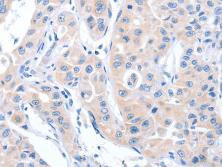 ARHGEF6 Polyclonal Antibody Store at -20°C - Biomarkers - Elabscience Biotechnology - MSE Supplies