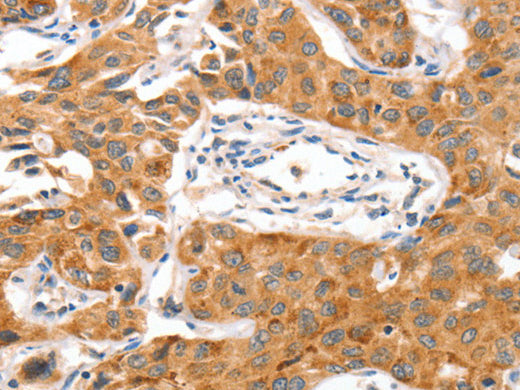 NUAK1 Polyclonal Antibody Store at -20°C - Biomarkers - Elabscience Biotechnology - MSE Supplies