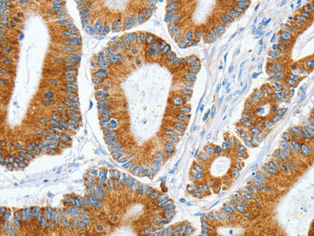 MANF Polyclonal Antibody Store at -20°C - Biomarkers - Elabscience Biotechnology - MSE Supplies