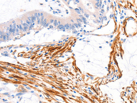 ARAP1 Polyclonal Antibody Store at -20°C - Biomarkers - Elabscience Biotechnology - MSE Supplies