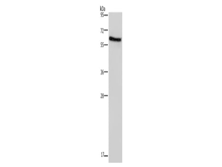 CD297 Polyclonal Antibody Store at -20°C - Biomarkers - Elabscience Biotechnology - MSE Supplies