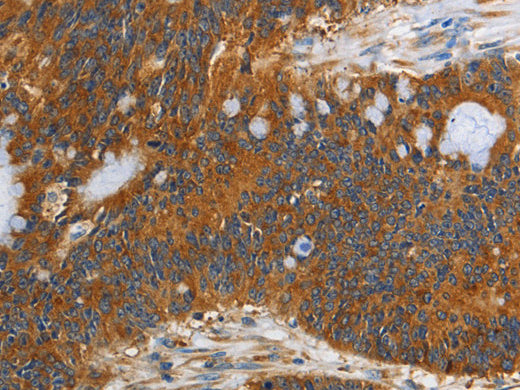 PI 3 Kinase Class 3 Polyclonal Antibody Store at -20°C - Biomarkers - Elabscience Biotechnology - MSE Supplies