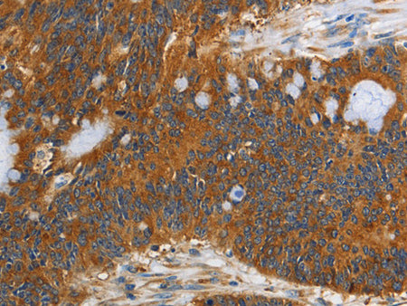 PI 3 Kinase Class 3 Polyclonal Antibody Store at -20°C - Biomarkers - Elabscience Biotechnology - MSE Supplies