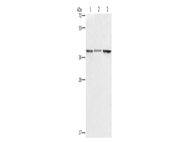 ZFP42 Polyclonal Antibody Store at -20°C - Biomarkers - Elabscience Biotechnology - MSE Supplies