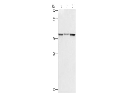 ZFP42 Polyclonal Antibody Store at -20°C - Biomarkers - Elabscience Biotechnology - MSE Supplies