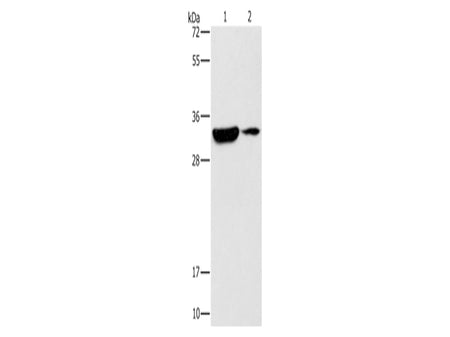 DSCR1 Polyclonal Antibody Store at -20°C - Biomarkers - Elabscience Biotechnology - MSE Supplies