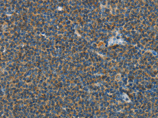 PITX3 Polyclonal Antibody Store at -20°C - Biomarkers - Elabscience Biotechnology - MSE Supplies