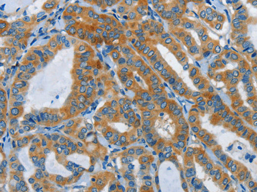 DDAH1 Polyclonal Antibody Store at -20°C - Biomarkers - Elabscience Biotechnology - MSE Supplies