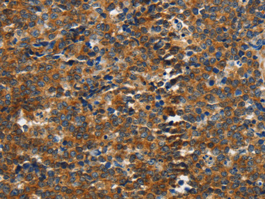 PIK3R4 Polyclonal Antibody Store at -20°C - Biomarkers - Elabscience Biotechnology - MSE Supplies
