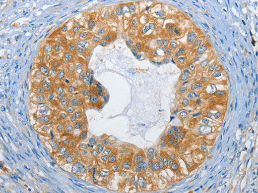 DGK Zeta Polyclonal Antibody Store at -20°C - Biomarkers - Elabscience Biotechnology - MSE Supplies