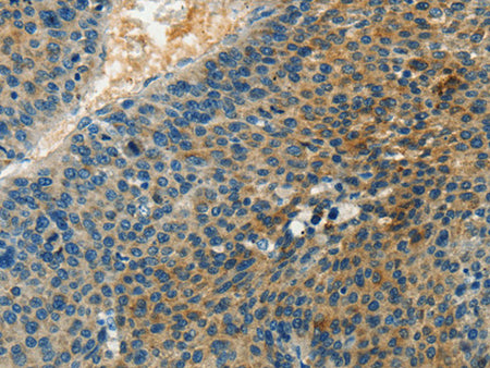 DGK Beta Polyclonal Antibody Store at -20°C - Biomarkers - Elabscience Biotechnology - MSE Supplies