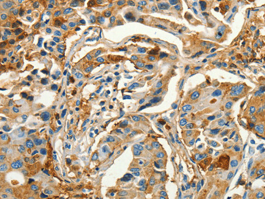 CALCA Polyclonal Antibody Store at -20°C - Biomarkers - Elabscience Biotechnology - MSE Supplies