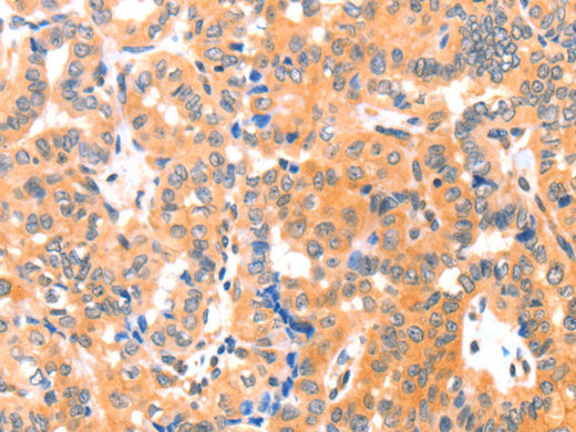 THBS1 Polyclonal Antibody Store at -20°C - Biomarkers - Elabscience Biotechnology - MSE Supplies