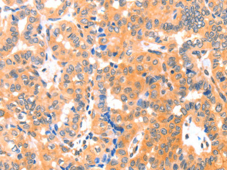 THBS1 Polyclonal Antibody Store at -20°C - Biomarkers - Elabscience Biotechnology - MSE Supplies