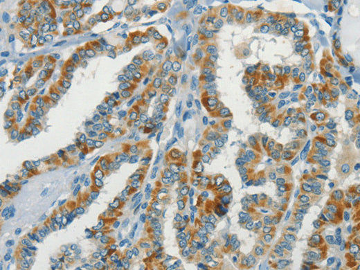 NPAP1 Polyclonal Antibody Store at -20°C - Biomarkers - Elabscience Biotechnology - MSE Supplies