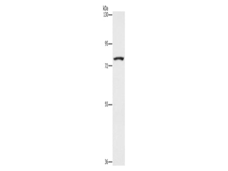SENP1 Polyclonal Antibody Store at -20°C - Biomarkers - Elabscience Biotechnology - MSE Supplies
