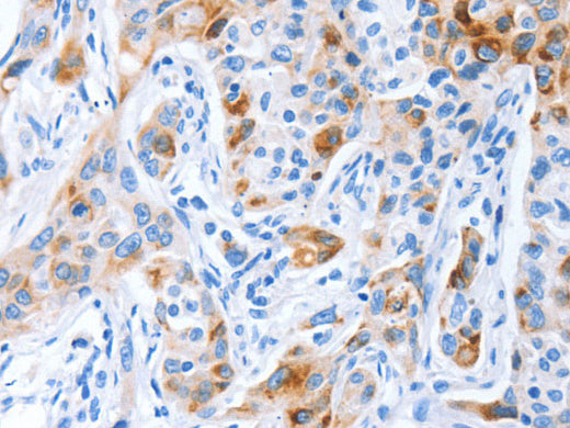 CD133 Polyclonal Antibody Store at -20°C - Biomarkers - Elabscience Biotechnology - MSE Supplies